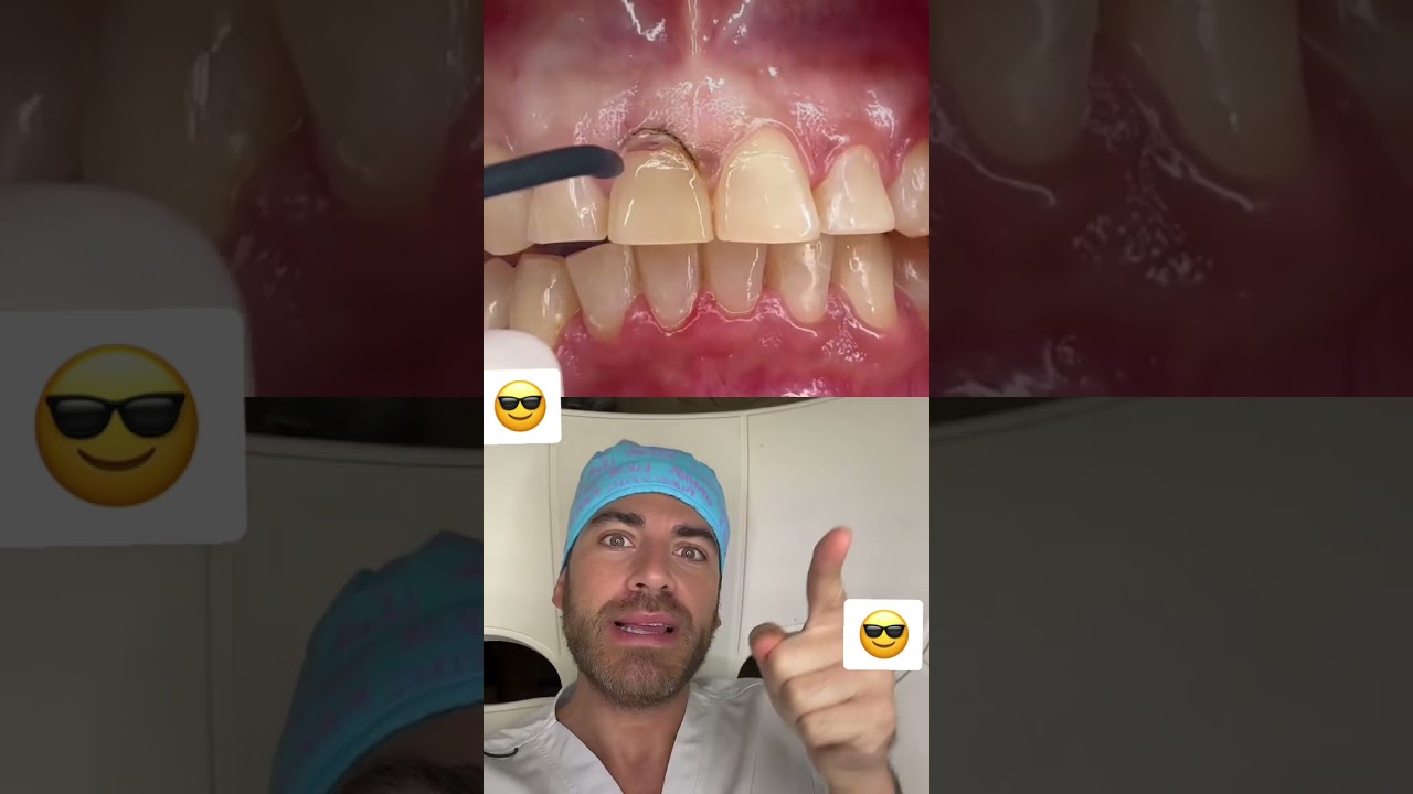 Ce dentiste a un laser!! 😎 #shorts